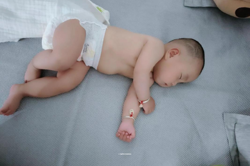 项城六个月宝宝眼睛散光